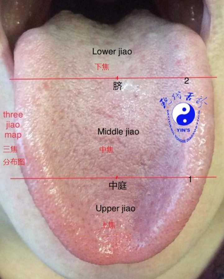 The three-Jiao map — Upper, Middle and Lower Jiao located on the tongue