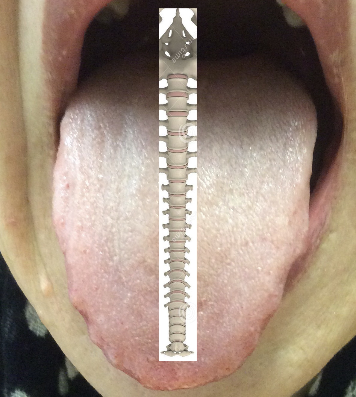 Tongue Midline Theory — the midline maps to the spine and Governor vessel